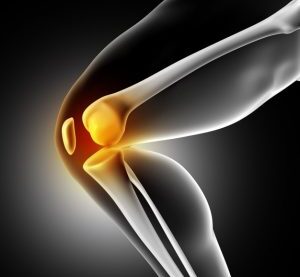 knee-pain-300x293